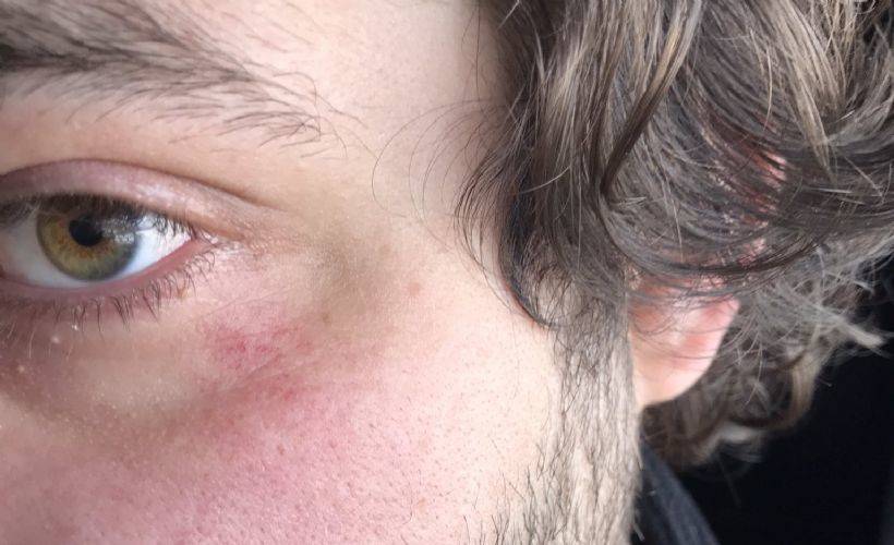 2 dakika erken kalkan otobüs şöförünü uyardı diye dayak yedi