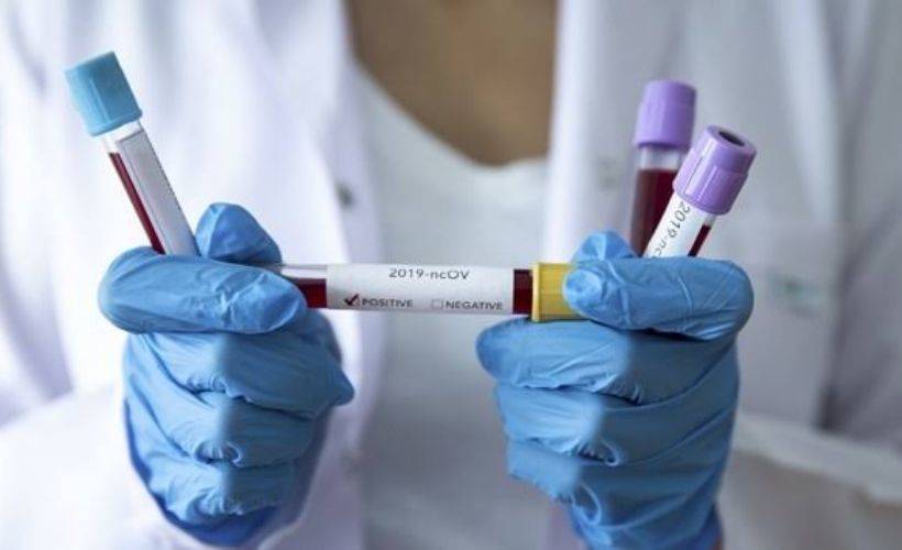 Türkiye'de 32 bin 404 kişinin Kovid-19 testi pozitif çıktı, 154 kişi hayatını kaybetti