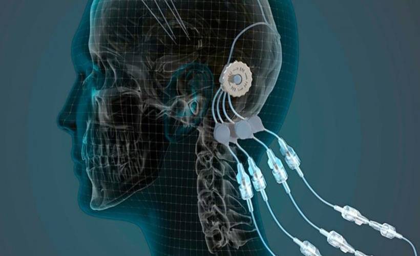 Parkinsona 'kızılötesi ışık' tedavisi