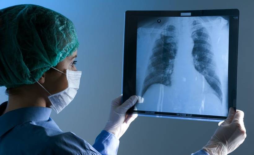 Akciğer kanseri evre evre yayılıyor