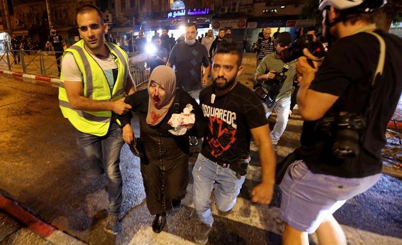 Yaralı Filistinli sayısı 305'e yükseldi