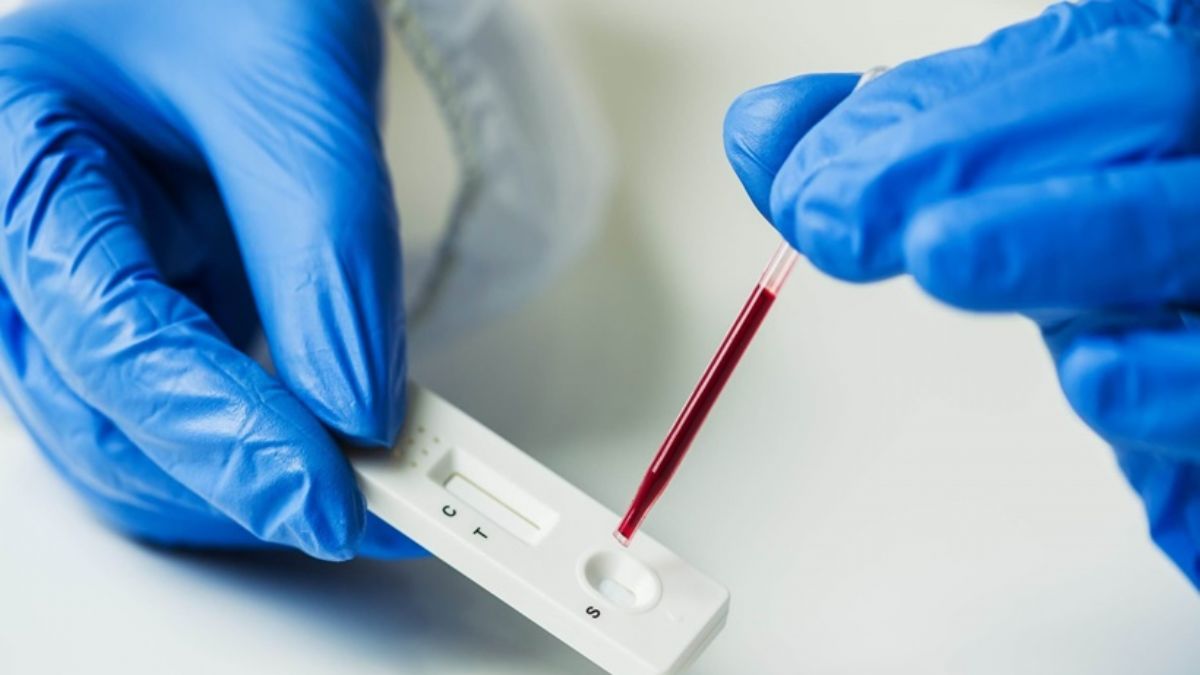 Antikor testi ve Kovid-19  ilişkisi