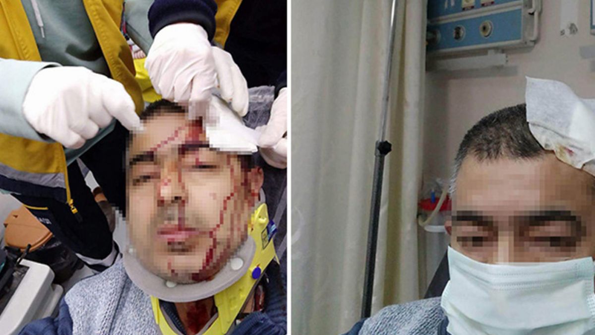 İmam, müezzine tabureyle saldırdı