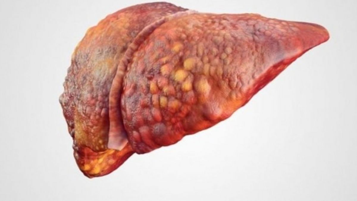 Ozon Tedavisi ve Karaciğer Yağlanması Tedavisi - TheLifeCo
