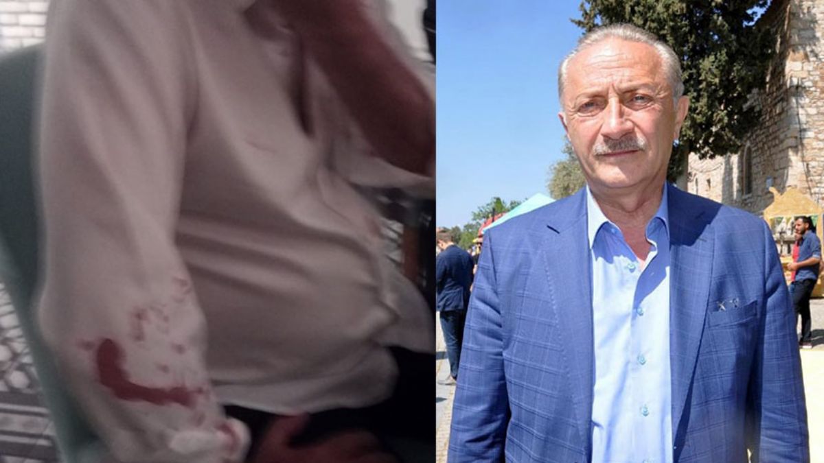 Didim Belediye Başkanı ve avukatı saldırıya uğradı