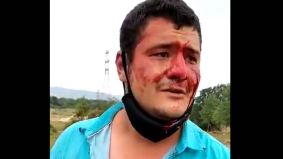 Kaçak yapı yıkımını görüntüleyen İHA muhabiri feci şekilde dövüldü!