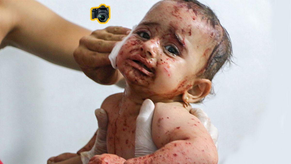 Esed rejiminin hedefinde yine çocuklar vardı