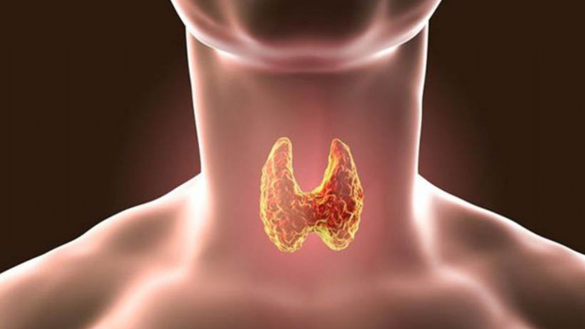 Haşimato hastalığının 10 belirtisi