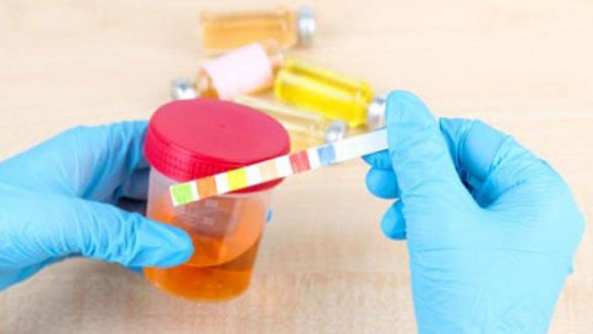 İdrar renginde neden değişme olur?