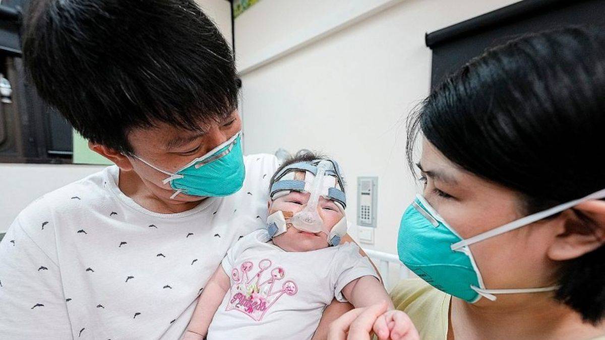 212 gram doğan bebek 13 ay sonra taburcu edildi