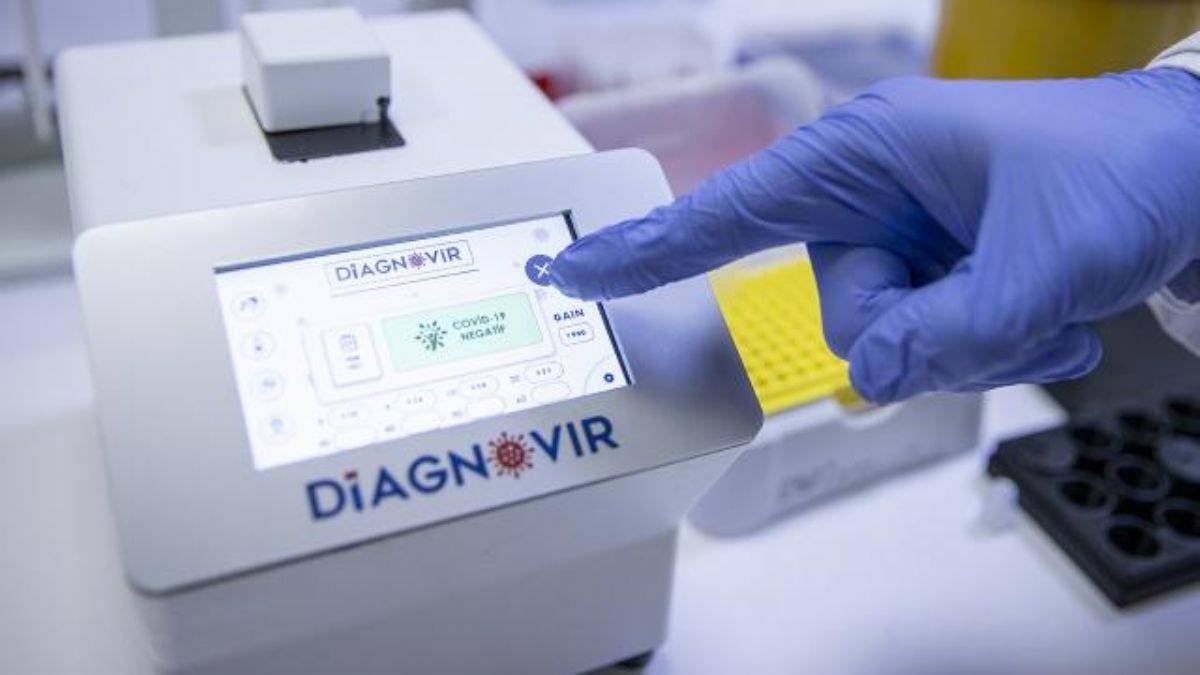 Koronavirüsü 10 saniyede teşhis eden 'Diagnovir' yerli test seri üretimde