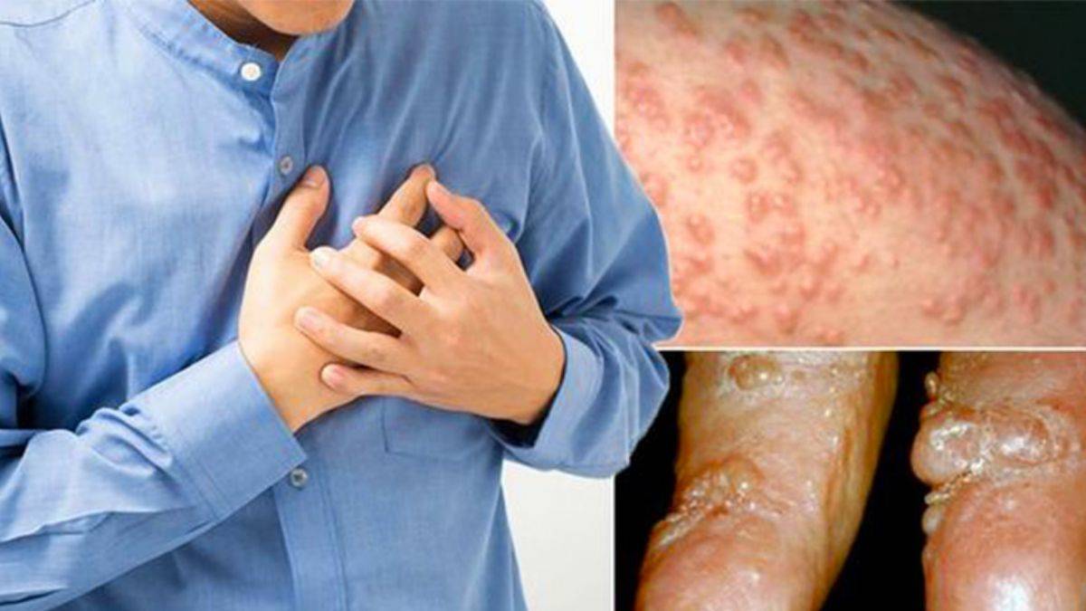 Cildinizdeki bu beş ince işareti neden asla görmezden gelmemelisiniz?