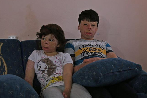 Suriyeli kardeşler ellerine kavuşmak istiyor