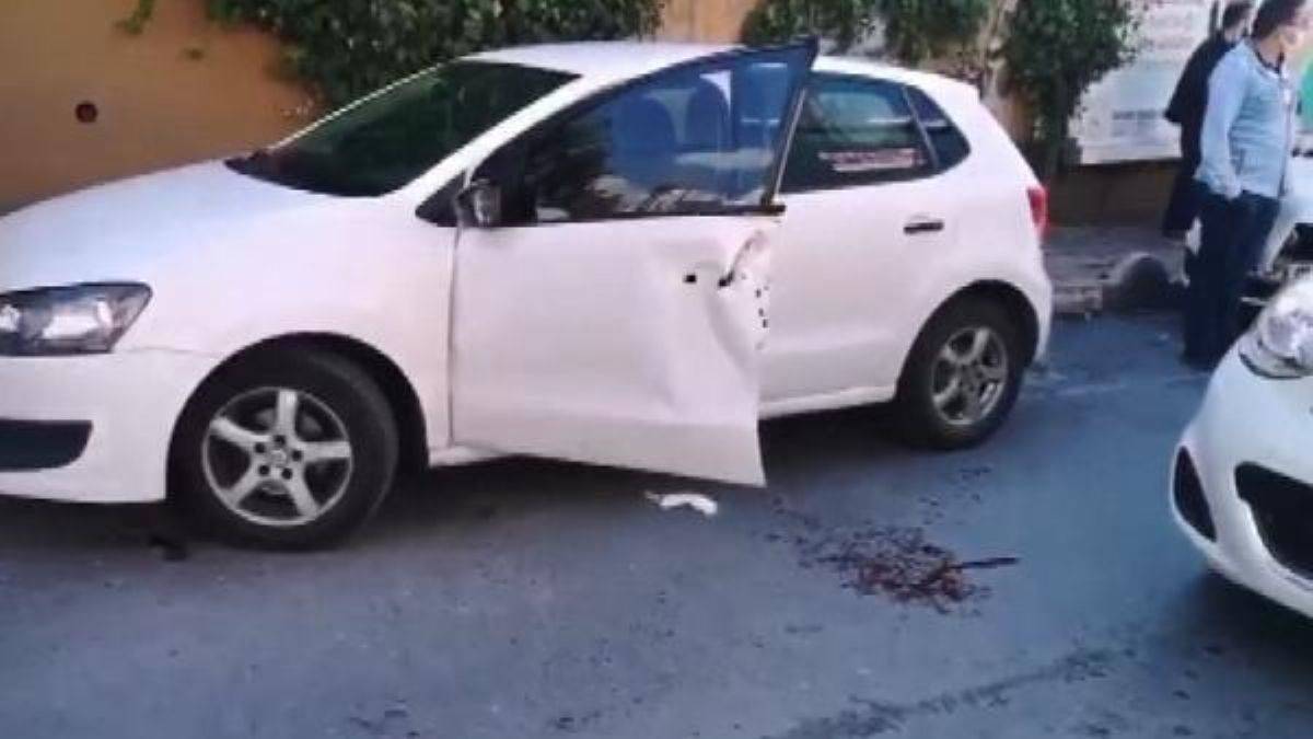 İnanılmaz kaza: Kopan parmaklarını alarak hastaneye koştu