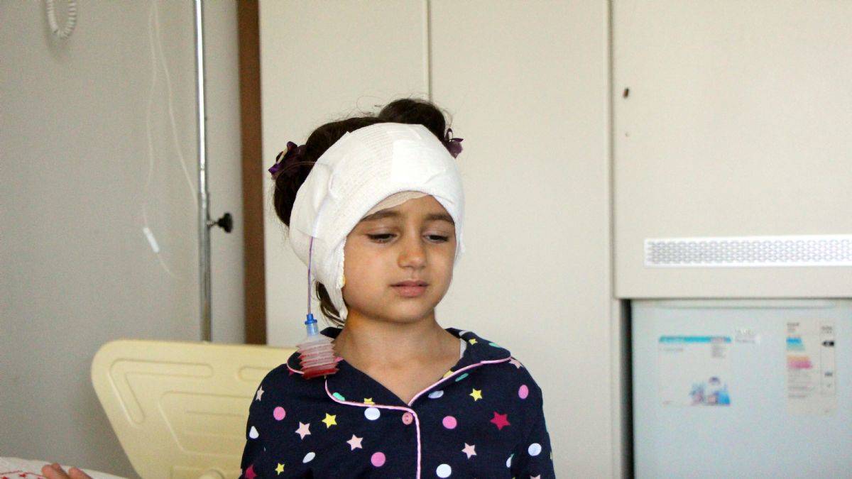 Alaz'ın köpek saldırısında kopan kulağına 300 dikiş