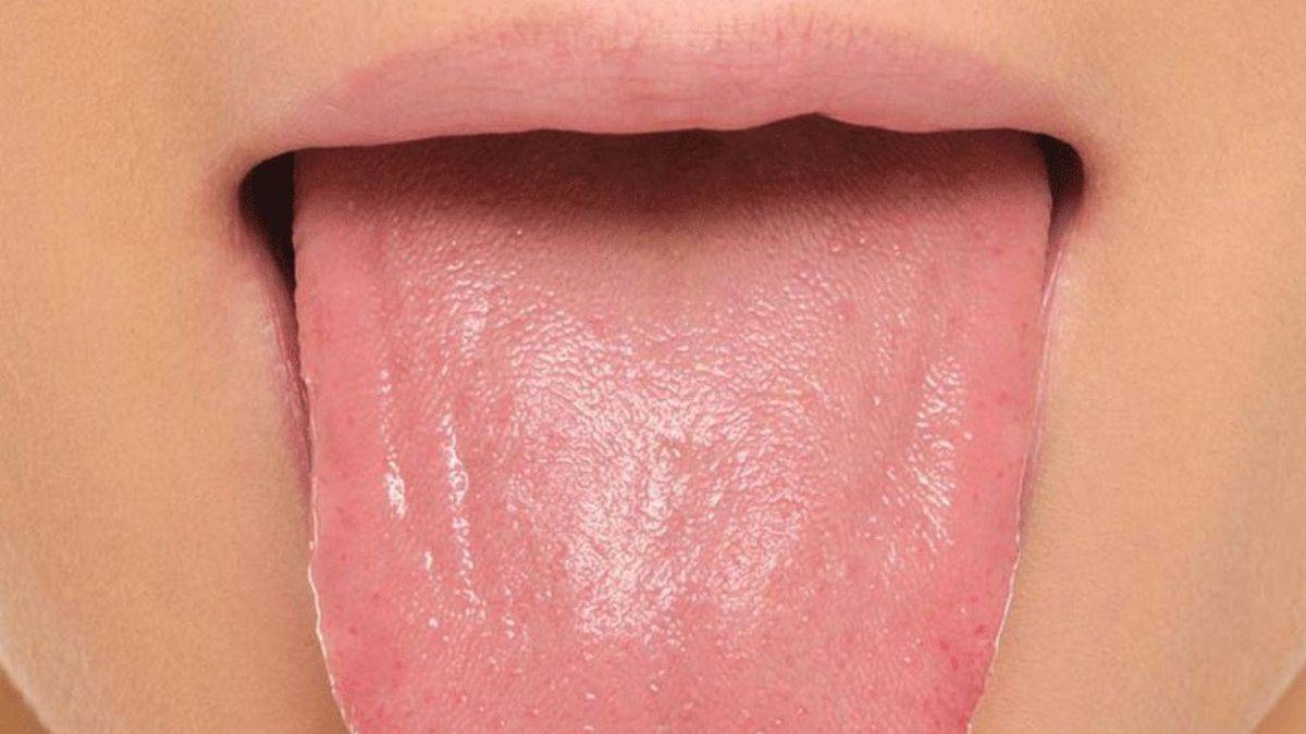 Diliniz sıcak içeceklere karşı hassaslaştıysa...