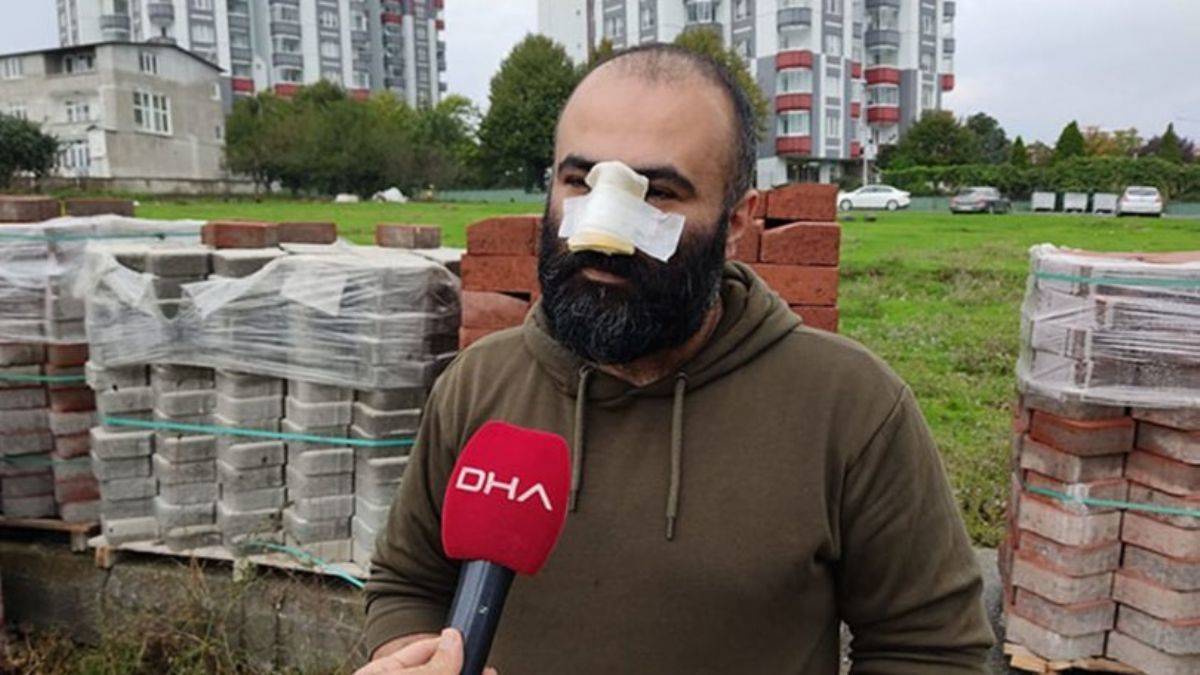 Tasmasız pitbull iş insanının burnunu kopardı