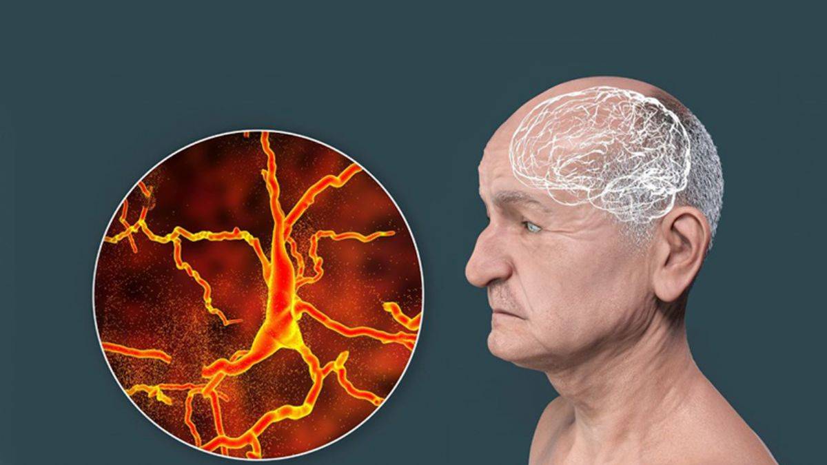 Demans ve felce karşı önemli adım: Laboratuvarda mini beyinler üretildi