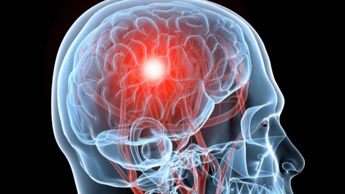 İklim değişikliğinin görünmeyen yüzü! Beyin damar hastalıklarını artırıyor