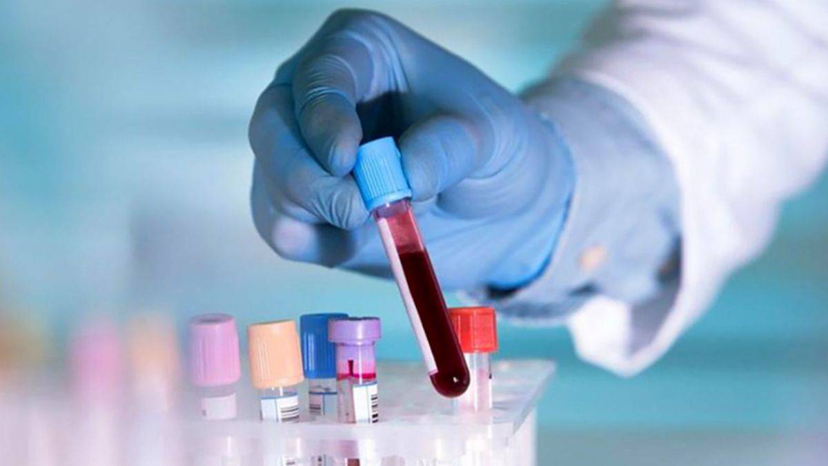 En sağlıklı kan grubu hangisi? Araştırmada ortaya çıktı