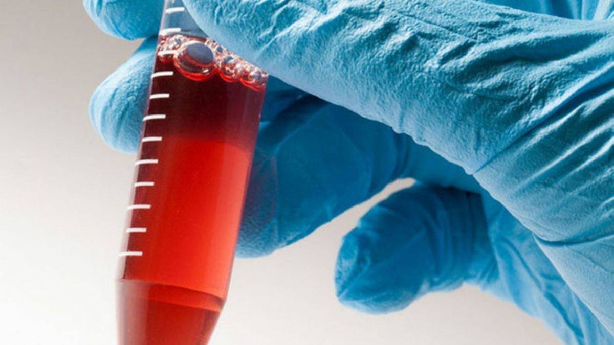 Kordon kanını saklarsanız...