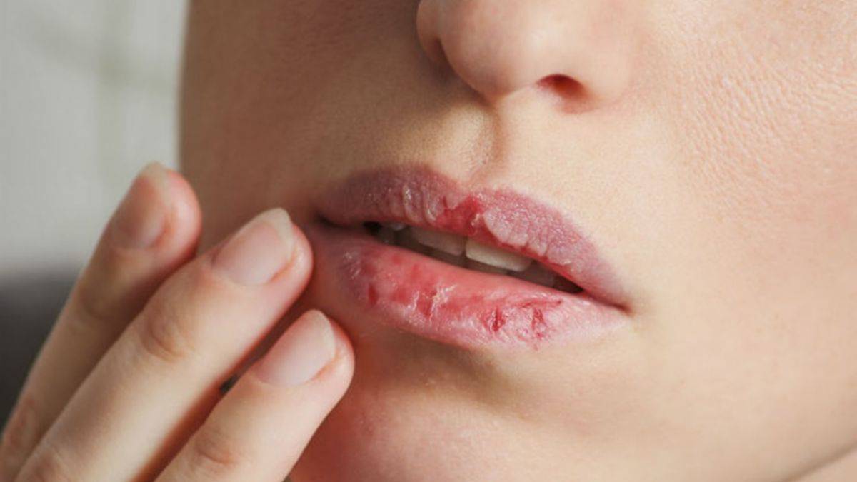 Sık sık dudaklarınız çatlıyorsa...