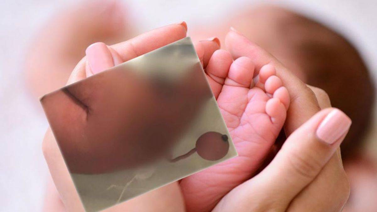 Bilim insanları şaşkına döndü: 12 santimetre kuyrukla doğdu