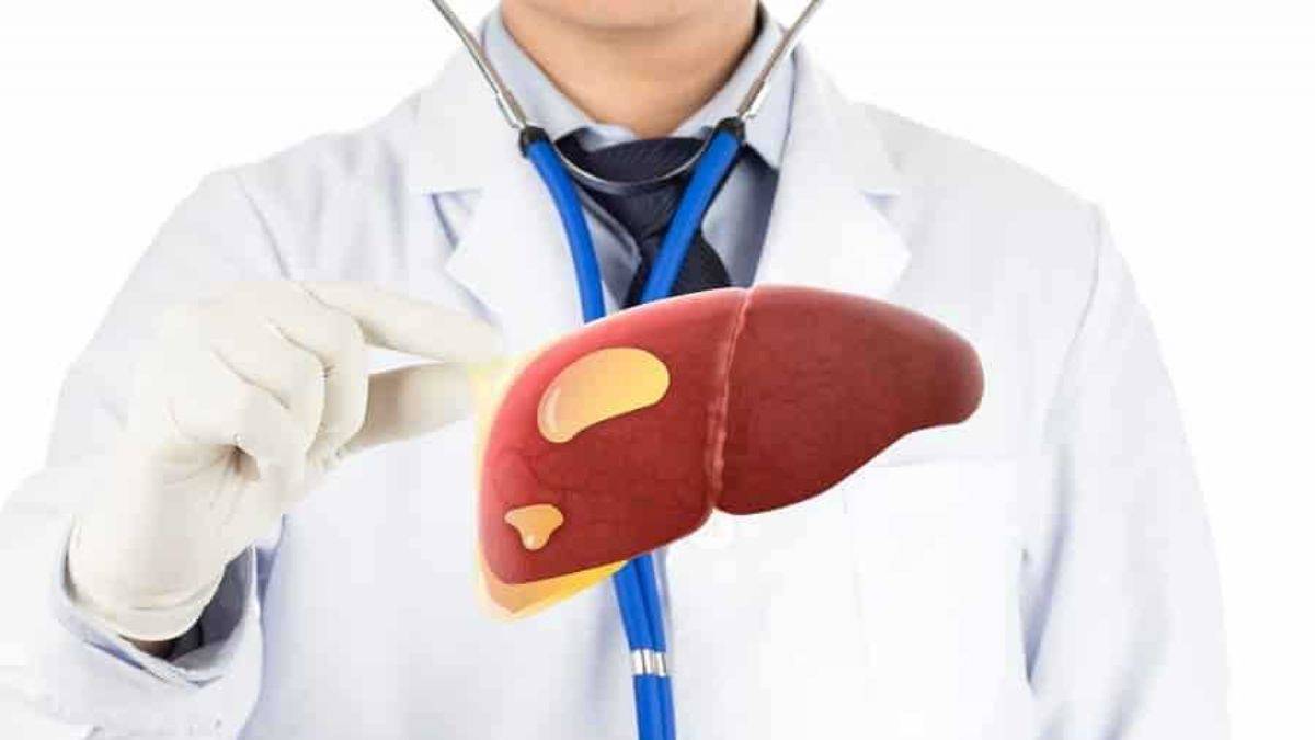 Karaciğerdeki bu yağlanma organ nakline götürebilir