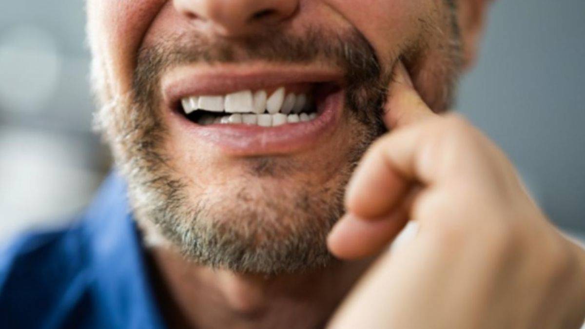 Ağız yaralarından kurtulmak için...