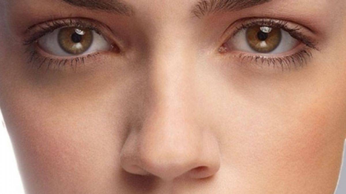 Göz altı morluklarından kurtulmak için...