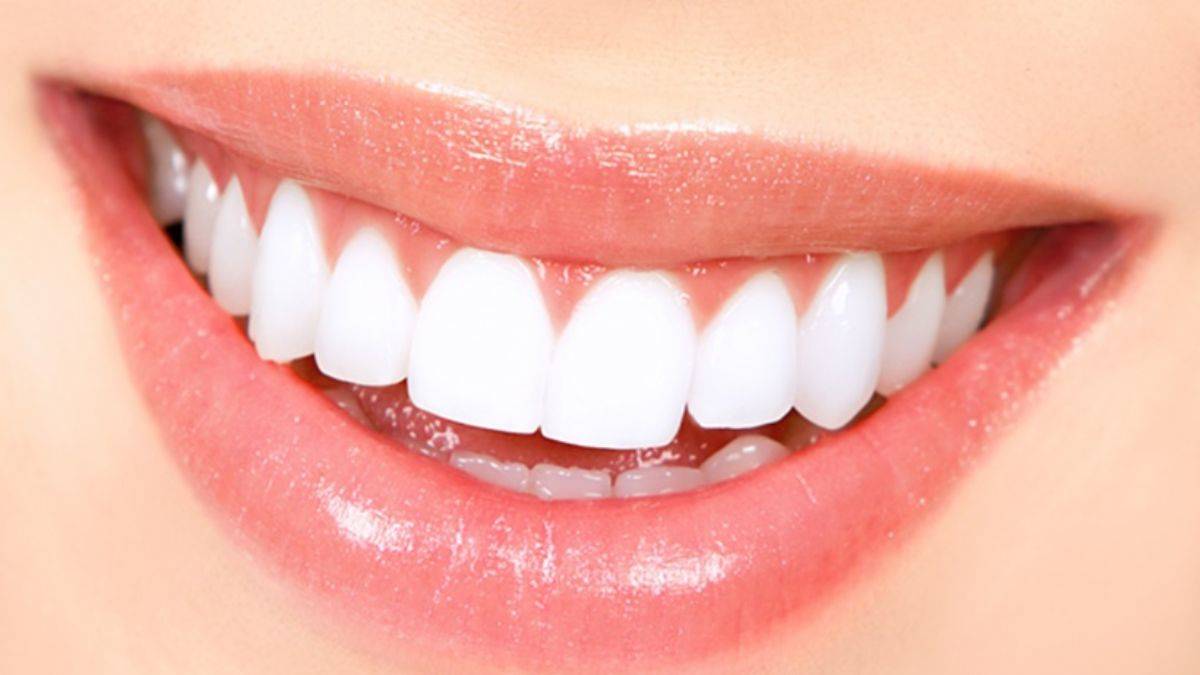 Evdeki malzemelerle bembeyaz dişlere kavuşun!