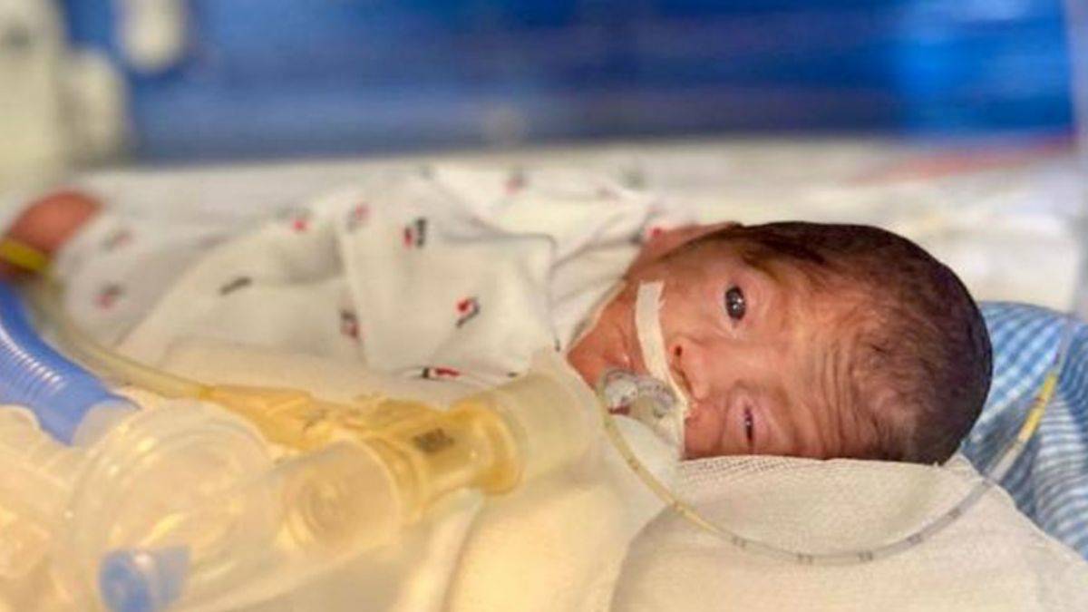 648 gram doğan ''Umut bebek'' herkese umut oldu