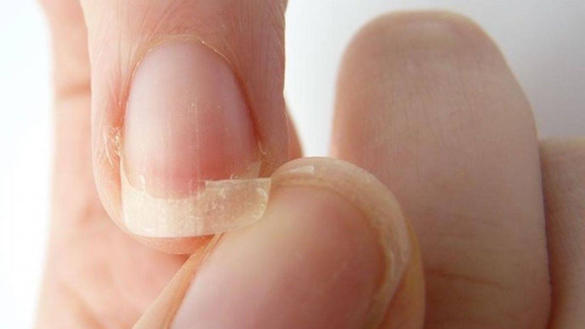 Tırnaklarımız neden kırılıyor?