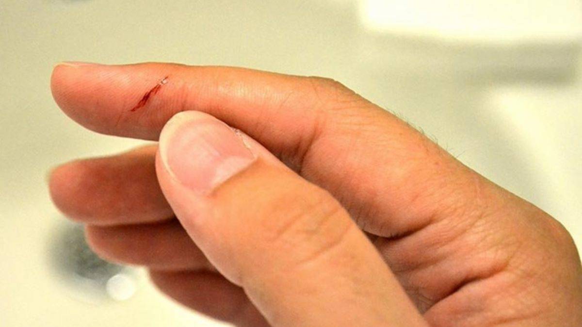 Mutfakta eliniz kesilirse bunları yapın