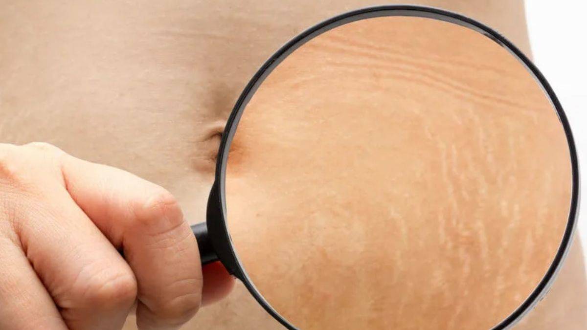 Nemlendiren çatlak kremi nasıl hazırlanır?