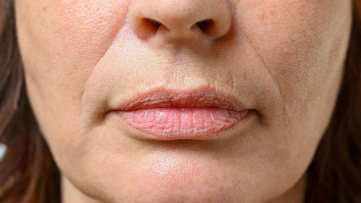 Kefir maskesi kırışıklıklara çözüm oluyor!