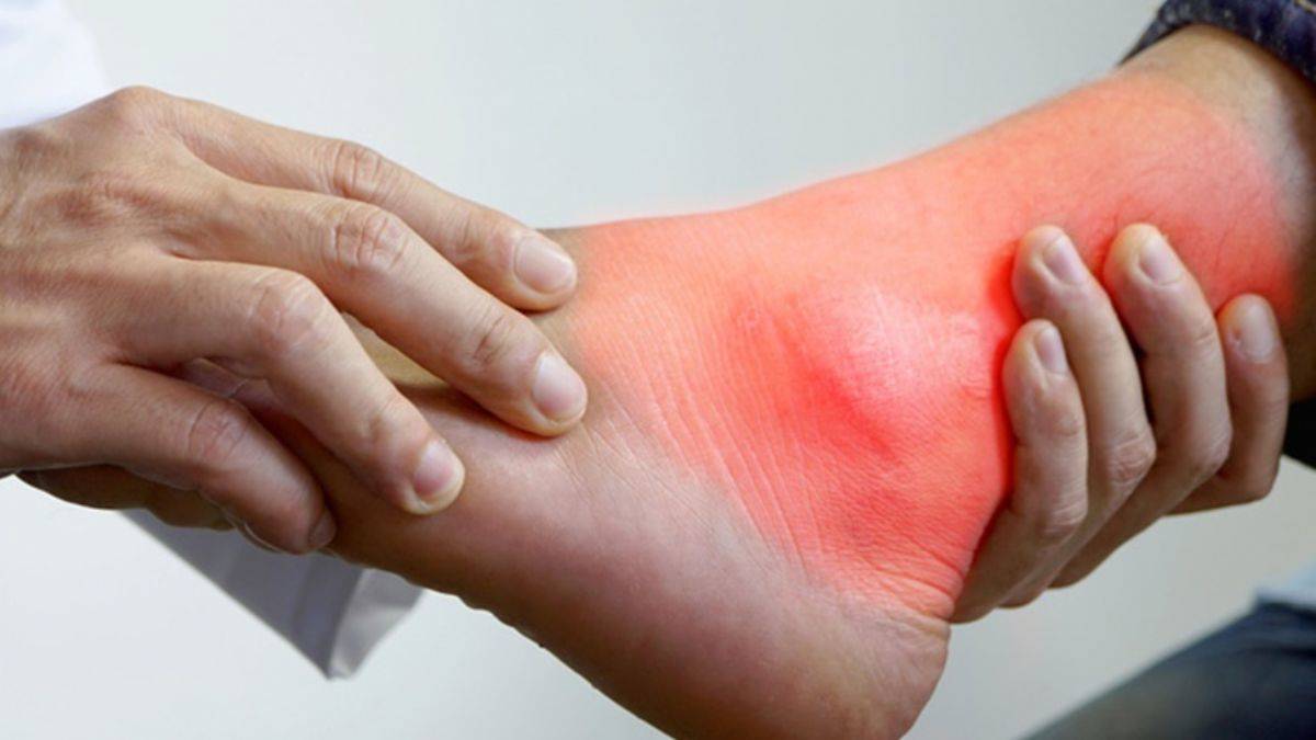 Gut hastalığı neden oluyor?