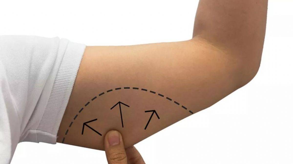 Kol sarkmalarını toparlamak için...