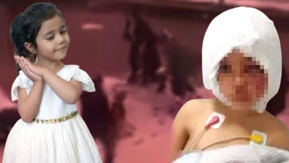 Pitbullun saldırdığı minik Asiye ile ilgili yeni gelişme