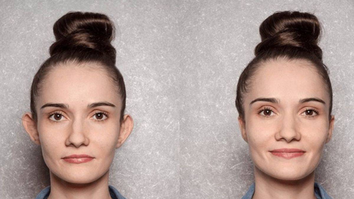 Kepçe kulak neden oluyor?