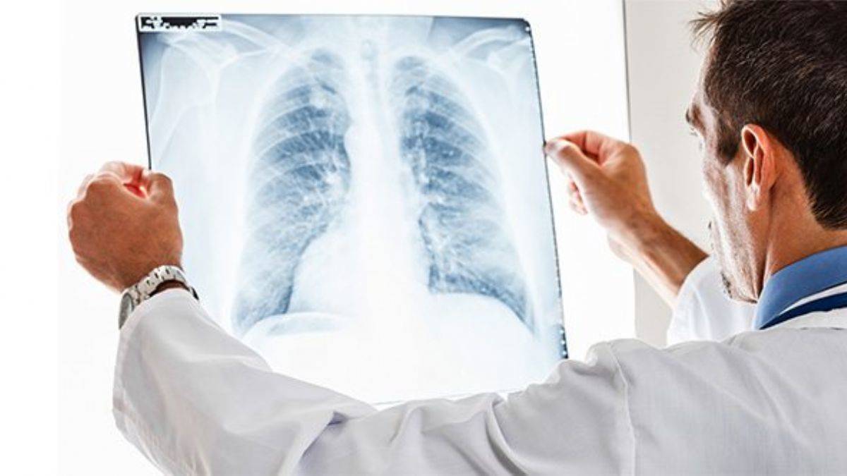 Omicron belirtileri | Omicron varyantı belirtileri ve tedavisi