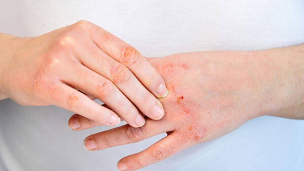 Soğuk havalarda kuruyan ellerinizi böyle yumuşatın