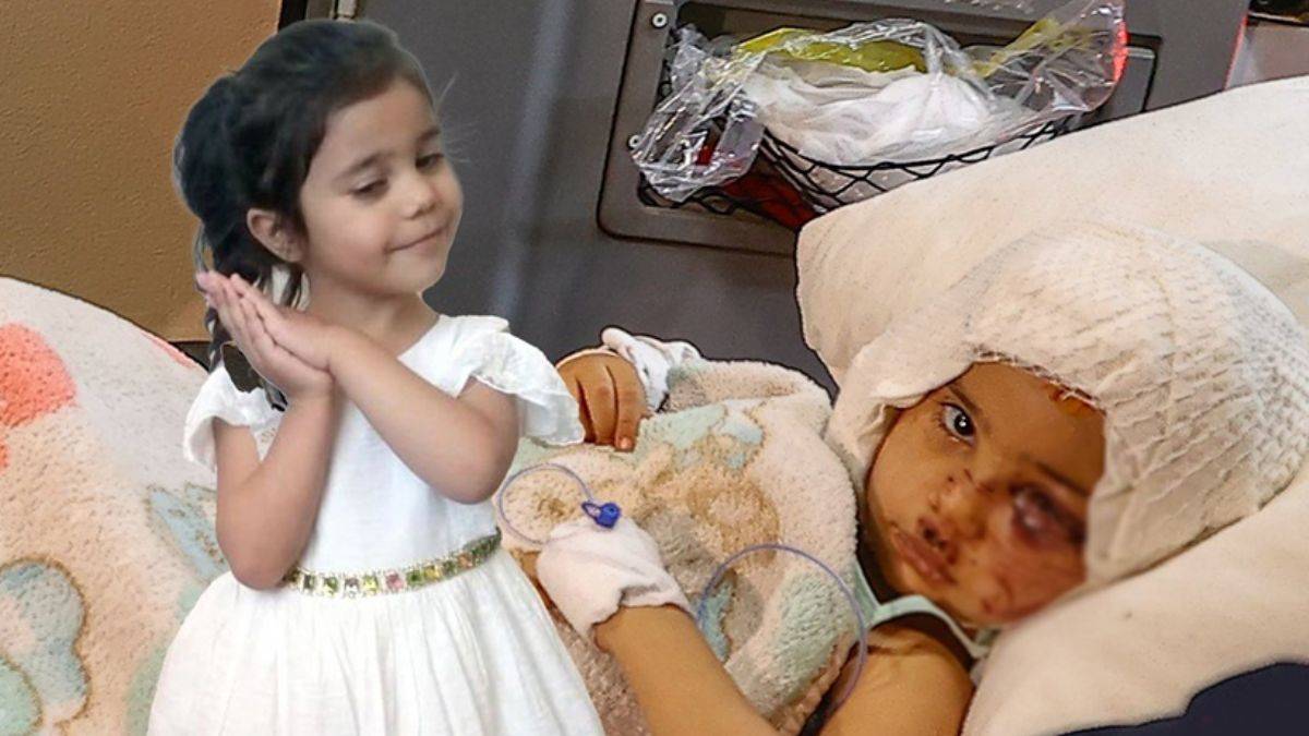 Minik Asiye, balon tekniğiyle saçlarına kavuşacak