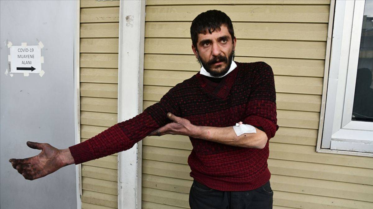 Bir pitbull saldırısı daha! 14 yerinden ısırdı