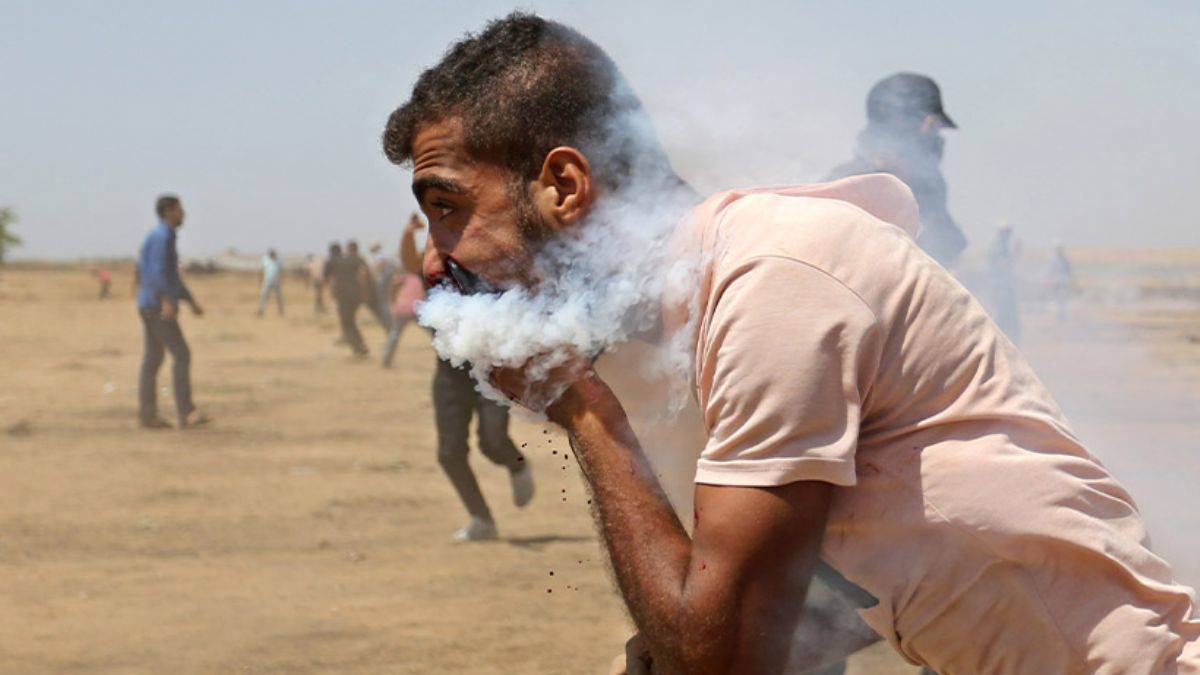 Ağzına gaz bombası isabet eden Filistinlinin acıları her geçen gün artıyor