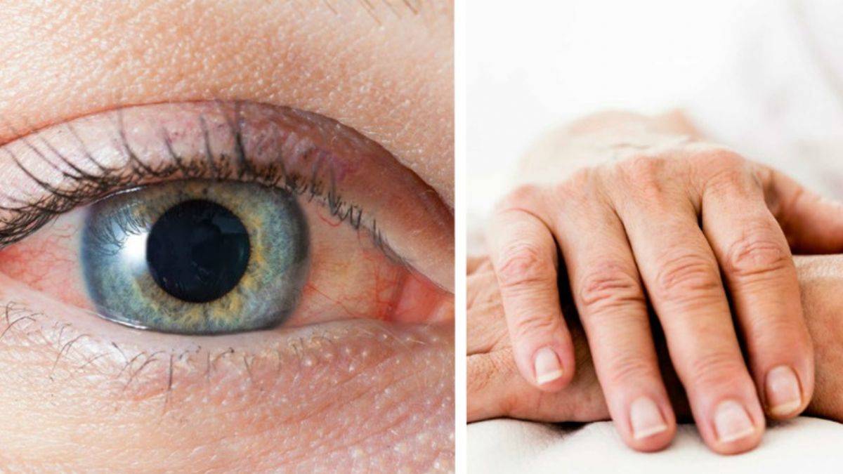 Vücudunuzda omega-3 eksik olursa...