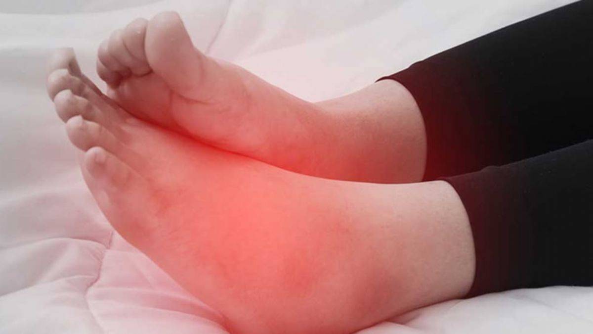 Gebelikte ayak ve bilek neden şişiyor?