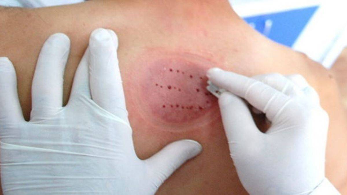 2022 Şubat ayı hacamat günleri nelerdir?