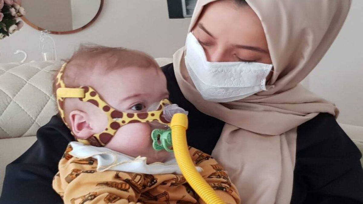 SMA hastalığının tedavisinde flaş gelişme