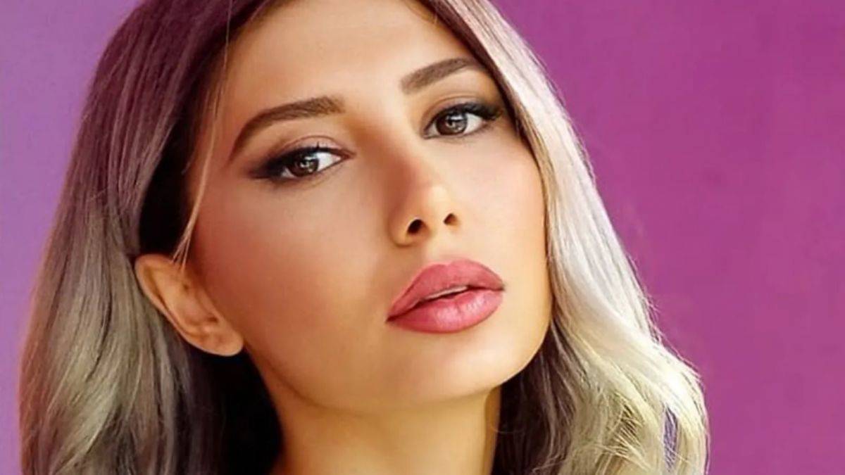 Şarkıcı Ceylan’ın kızı Melodi estetik mi yaptırdı?